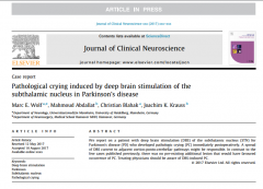 帕金森病患者丘脑下核深部电刺激诱发的病理性哭泣