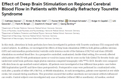 深部脑刺激DBS对难治性抽动秽语综合征患者局部脑血流的影响