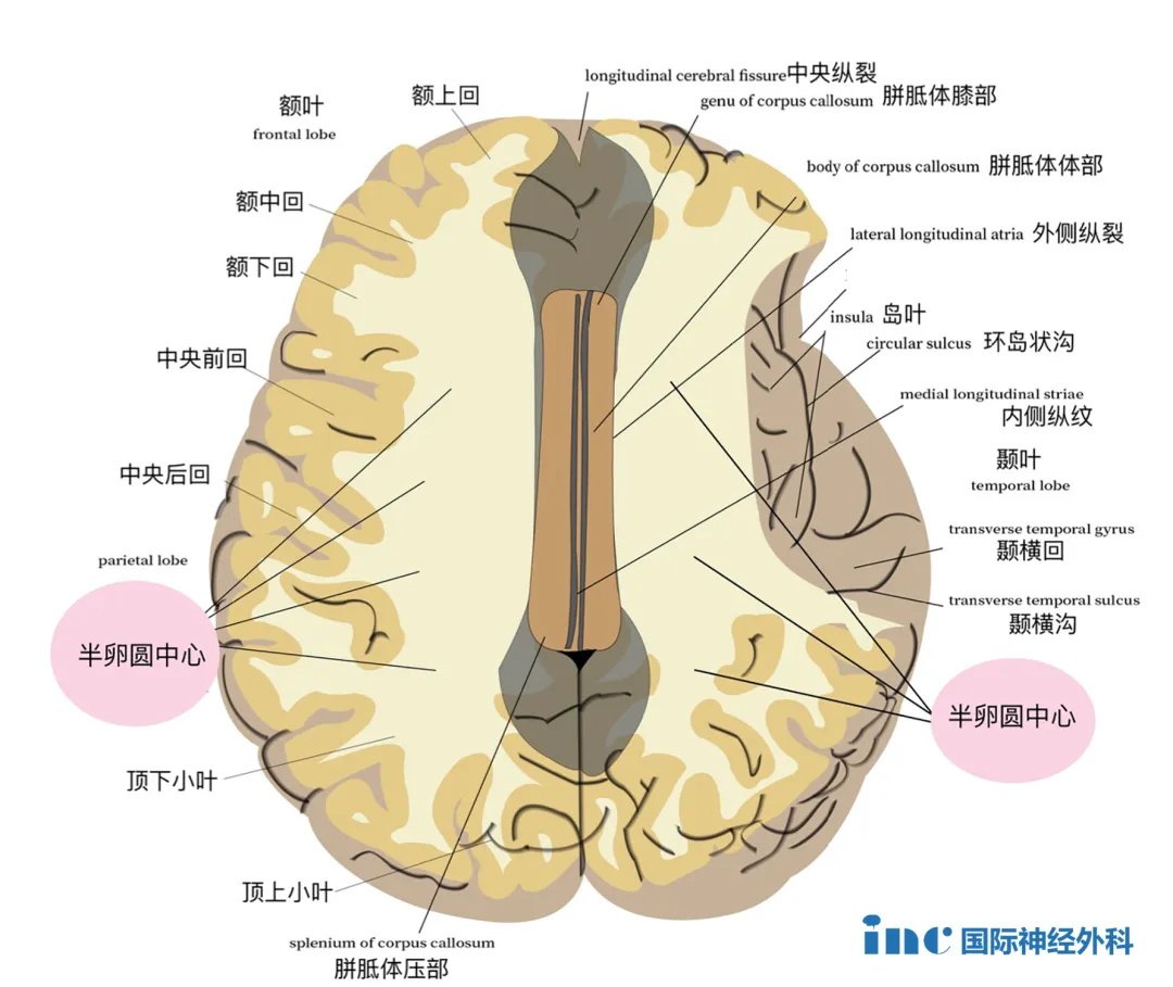 半卵圆中心图片