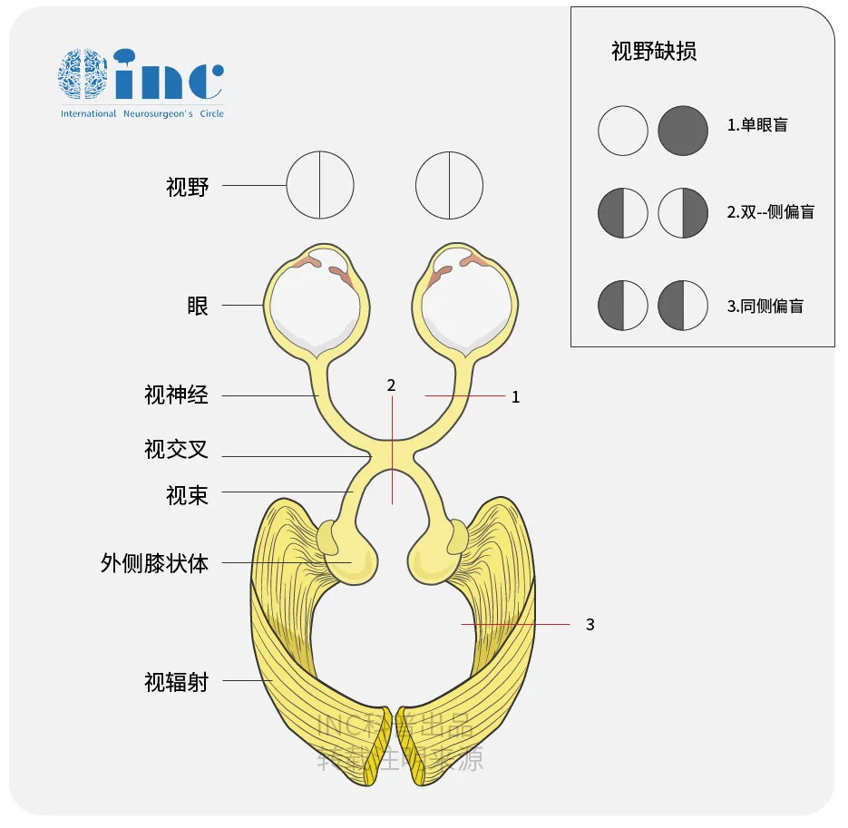 视神经科普图片