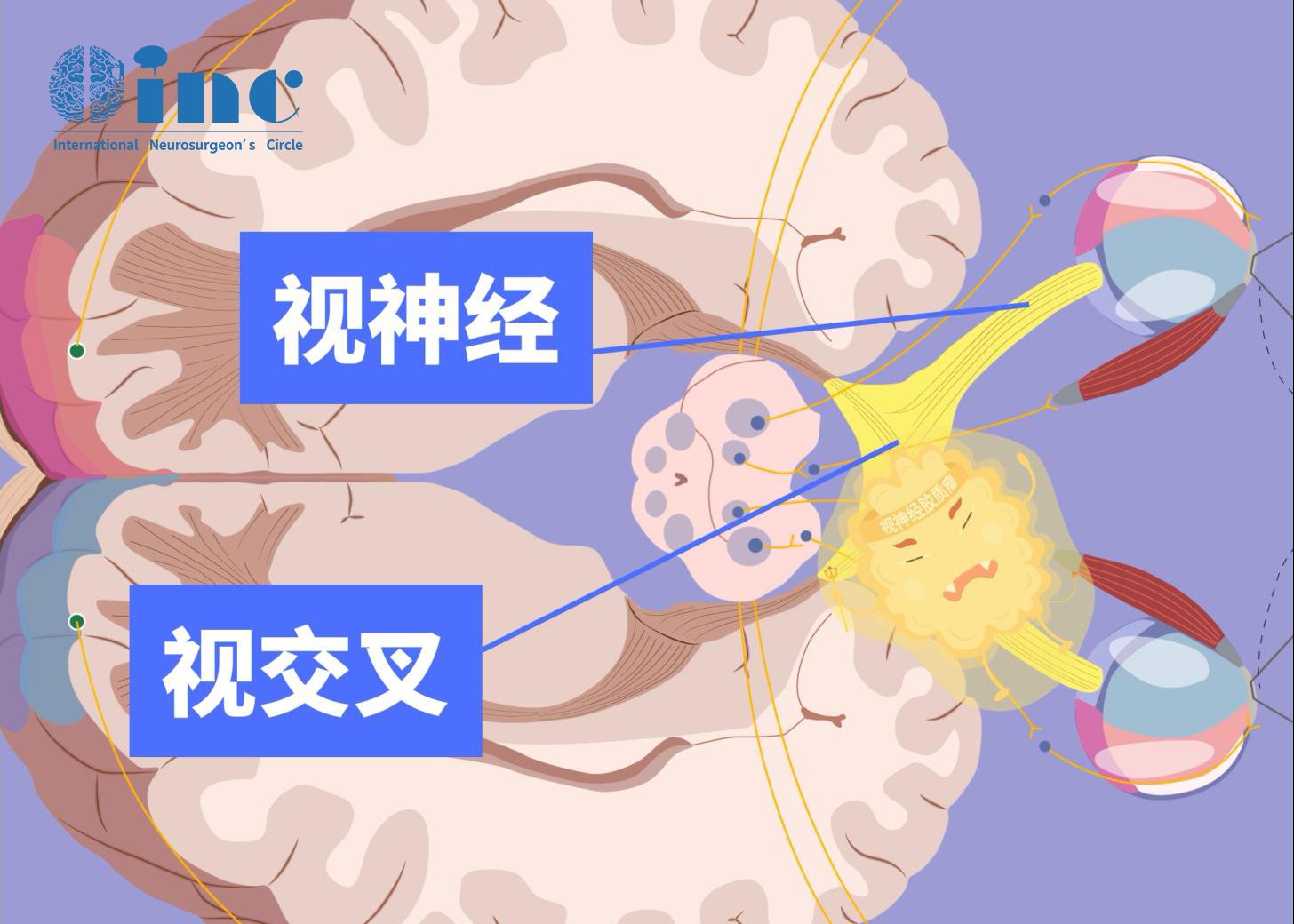 视神经图片