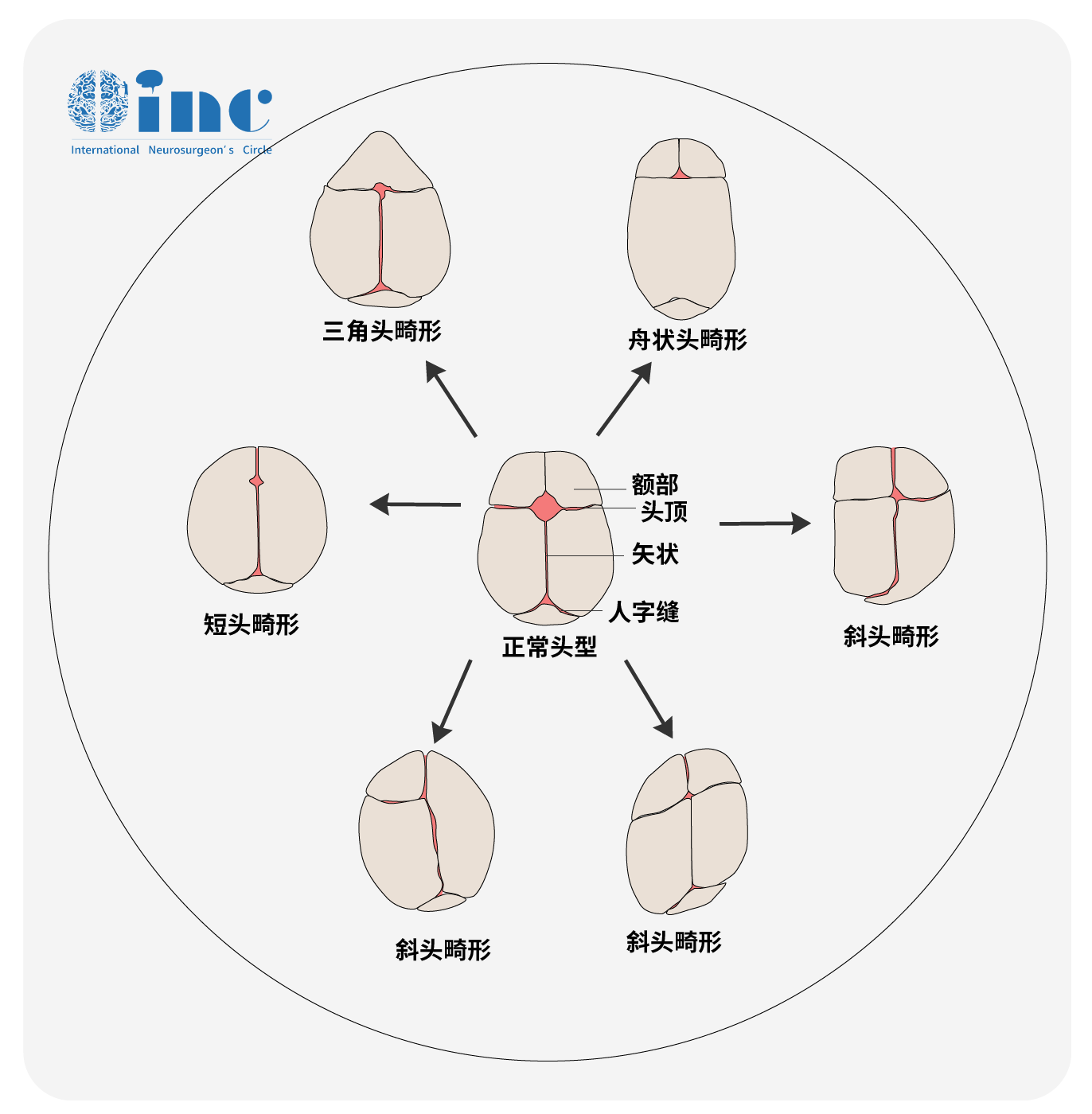 不同颅骨图片