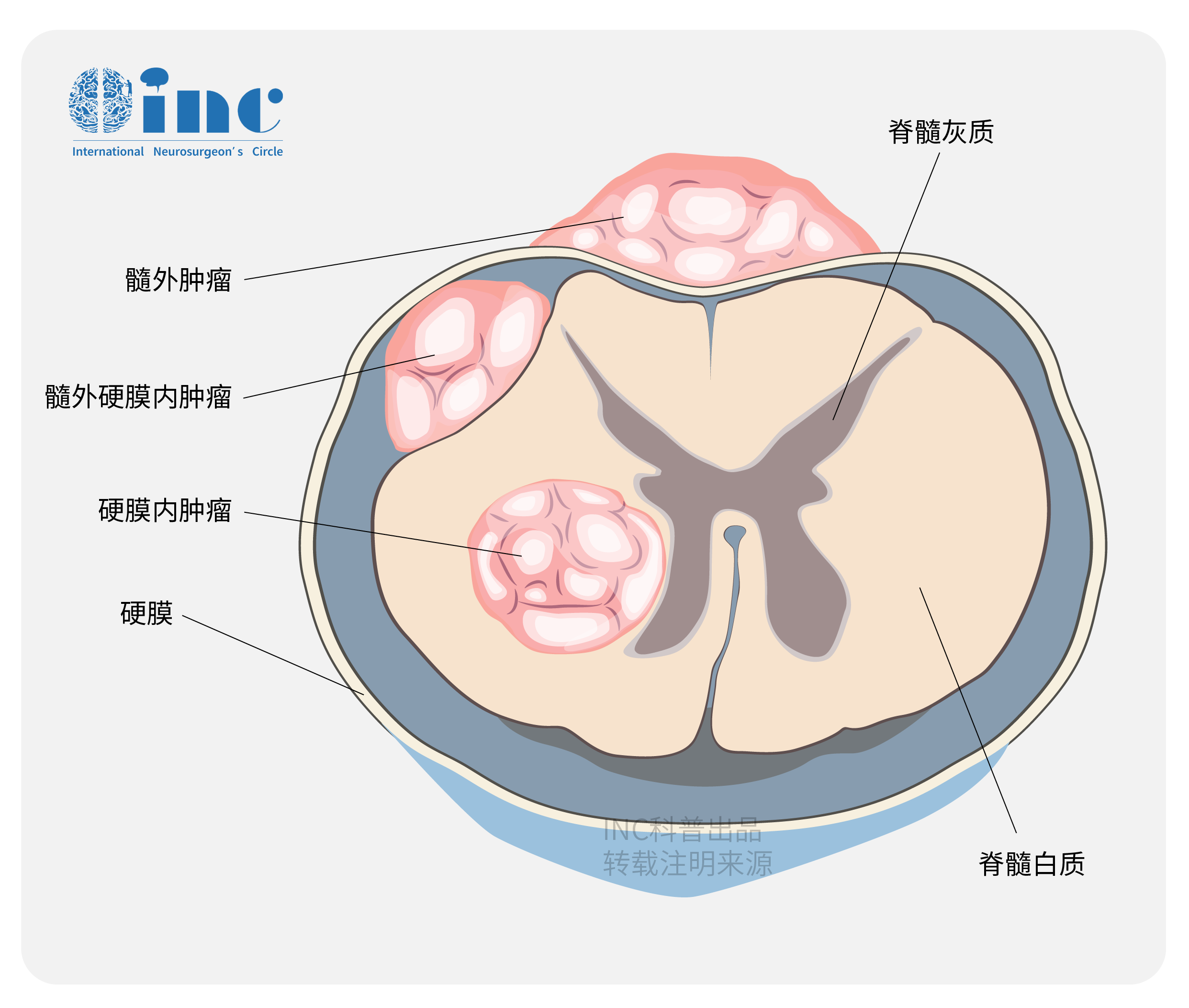 脊髓灰质图片