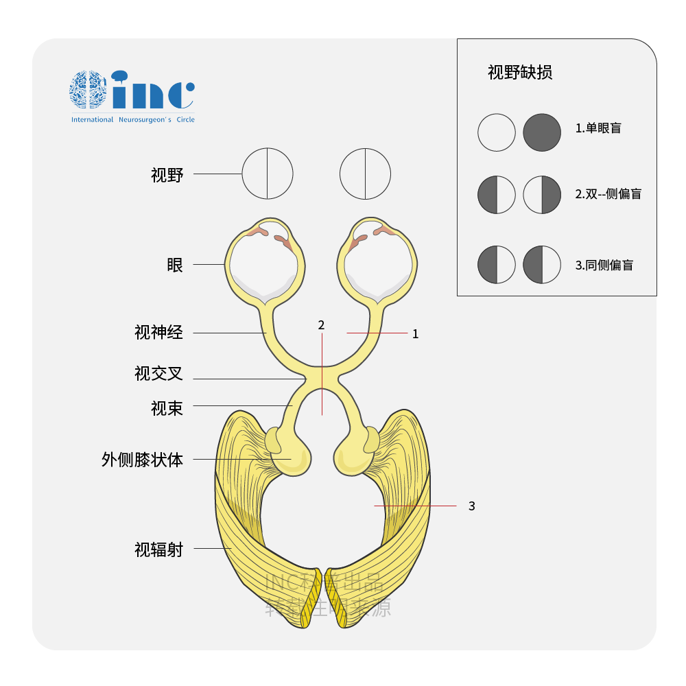 视神经及视野图片