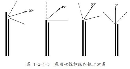 神经内镜