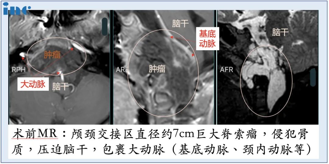 术前术后影像对比