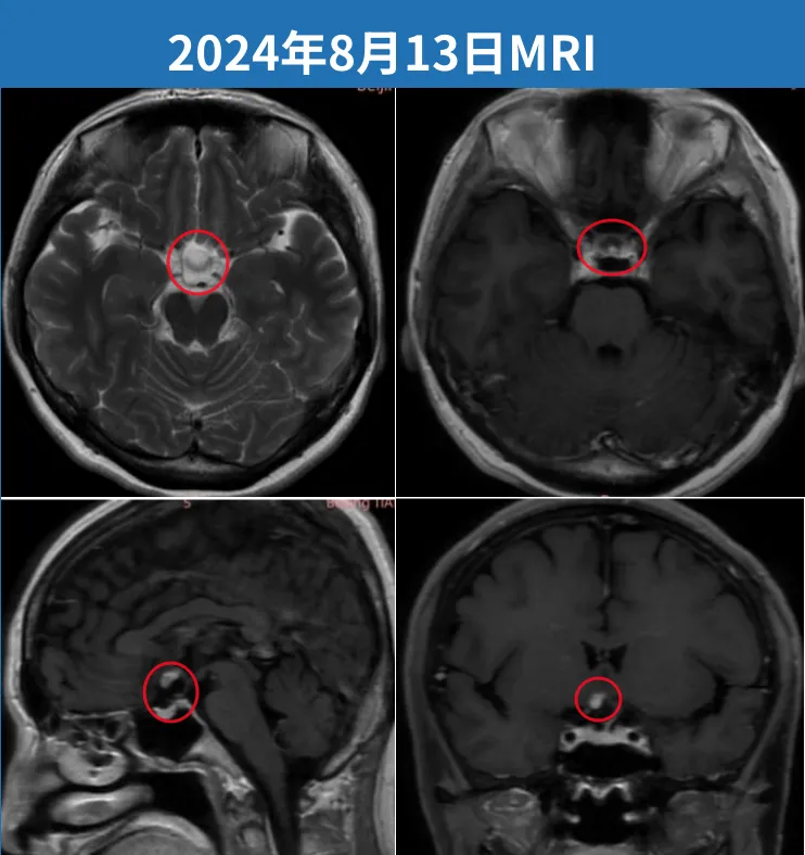 巴特朗菲教授