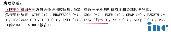 术后一个月韩先生术后病理结果为低级别胶质瘤