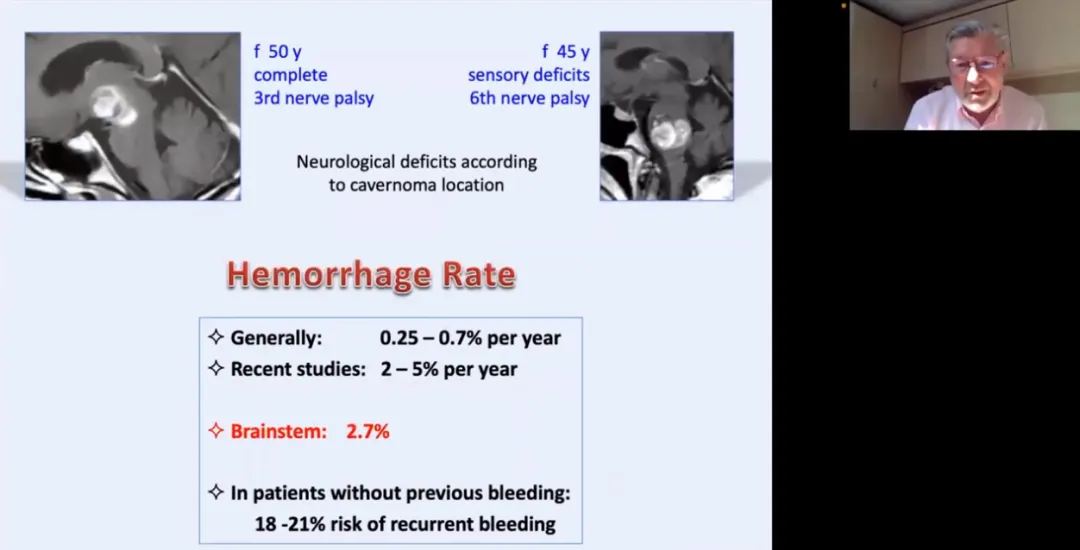 英国海绵状血管瘤联盟2022年论坛会上，巴教授分享的出血概率。