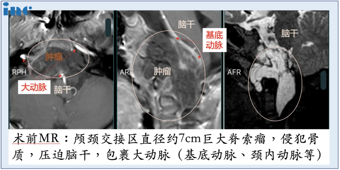 术前术后影像对比