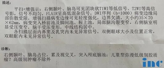 “想办法找到实力、经验更强的医生”