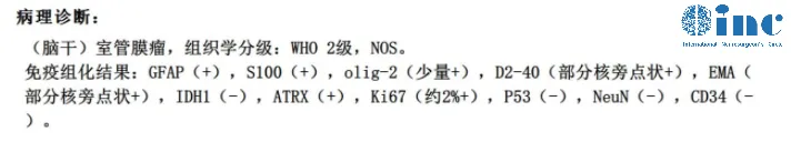 术后一个月，郑女士病理结果为室管膜瘤WHO 1级。