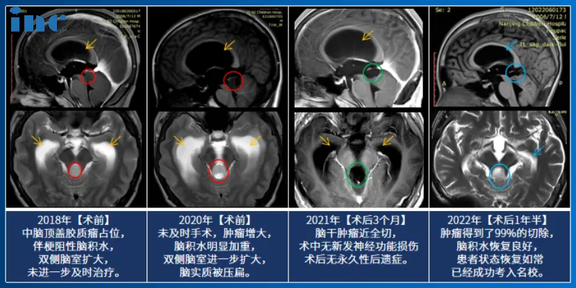 患者情况