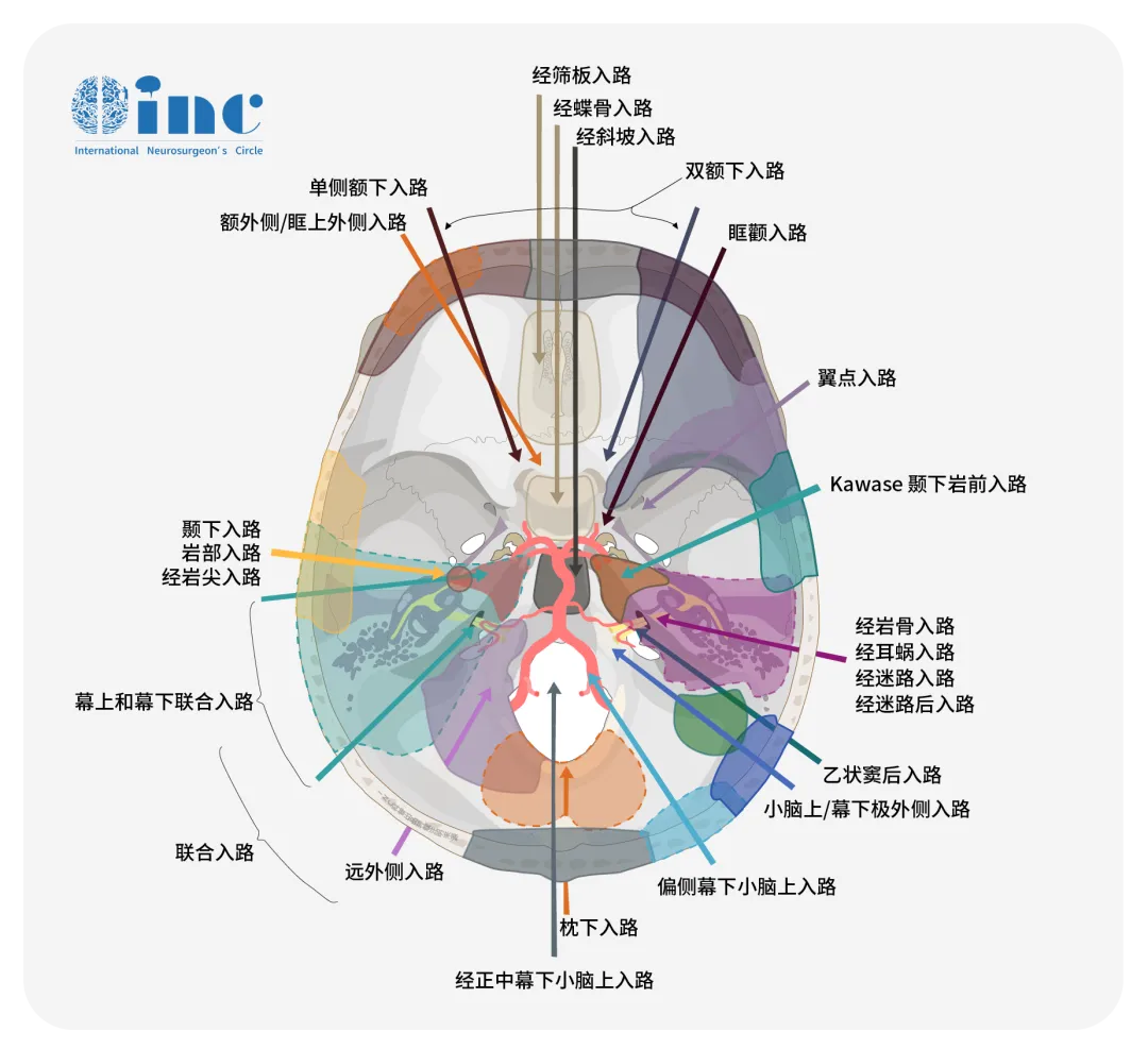 颅咽管瘤手术入路