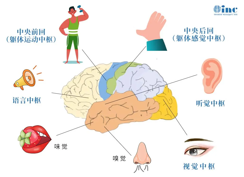 在脑功能区上手术有多难？国际神外大咖精准定位、铲除“不定时炸弹”