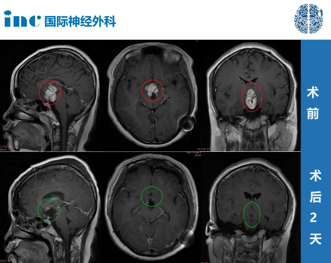 对比