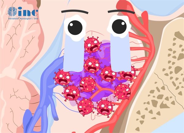 脑血管瘤撞击破裂怎么办